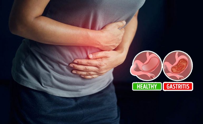 ගැස්ට්‍රයිටිස්