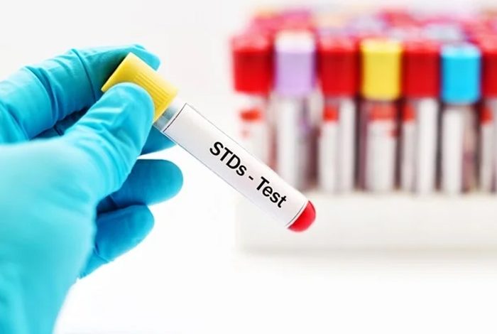 ලිංගාශ්‍රිත රෝග -stds
